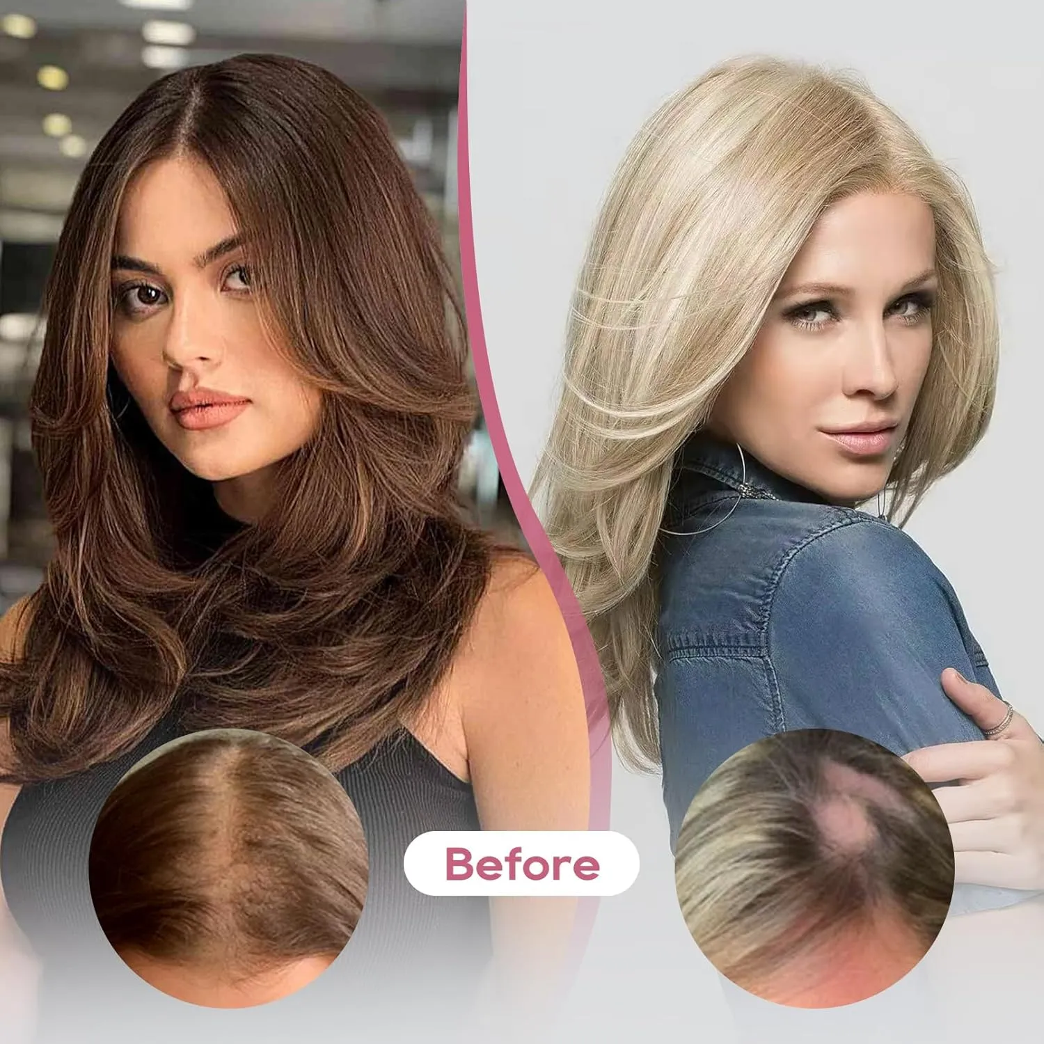 REECHO Human Hair Topper, 10 Inch Hair Toppers for Women Real Human Hair, Real Human Wiglet Adding Targeted Coverage for Thinning Hair, White Blonde